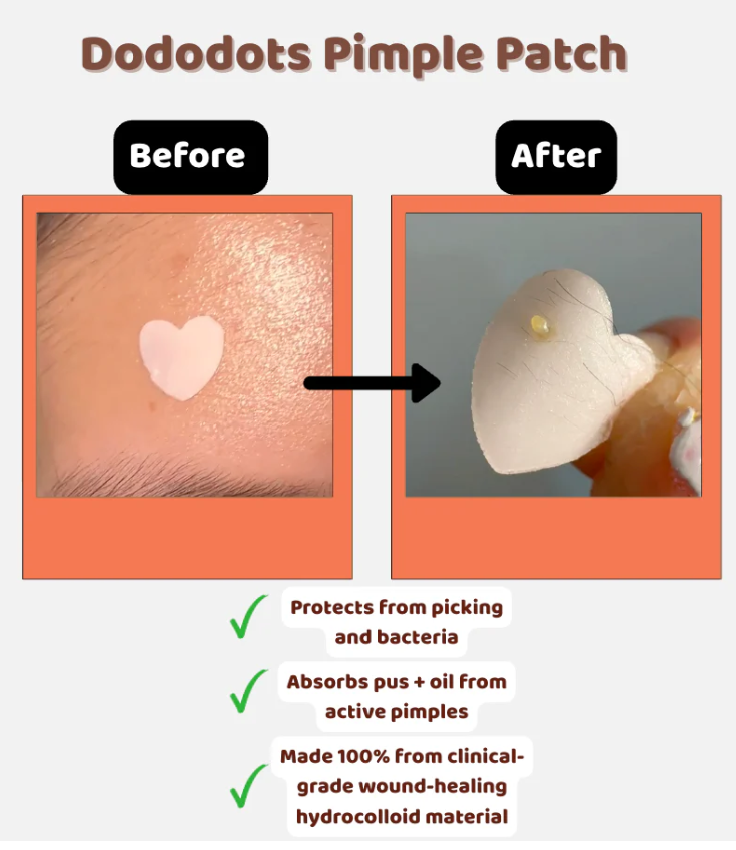 PAC of 3 Dododots Pimple Patch | Cute Hydrocolloid Acne Stickers for Fast Blemish Care